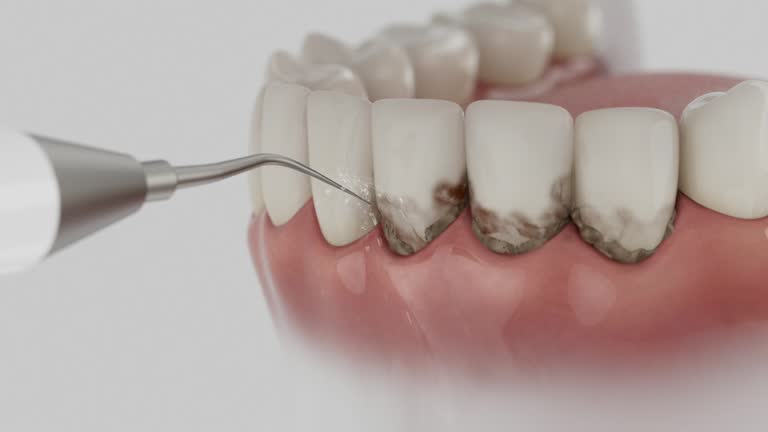 Reliable Dental Implants contractor in Montague County County, TX by Dentist Open Now